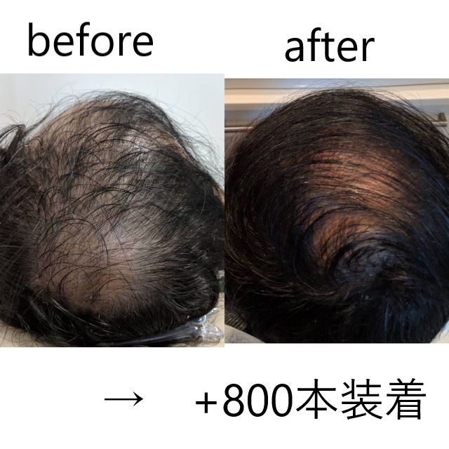 美養サロンEnbi 縁美｜Men'sBeauty掲載店舗