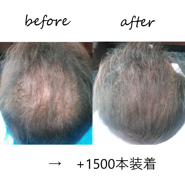 美養サロンEnbi 縁美｜Men'sBeauty掲載店舗