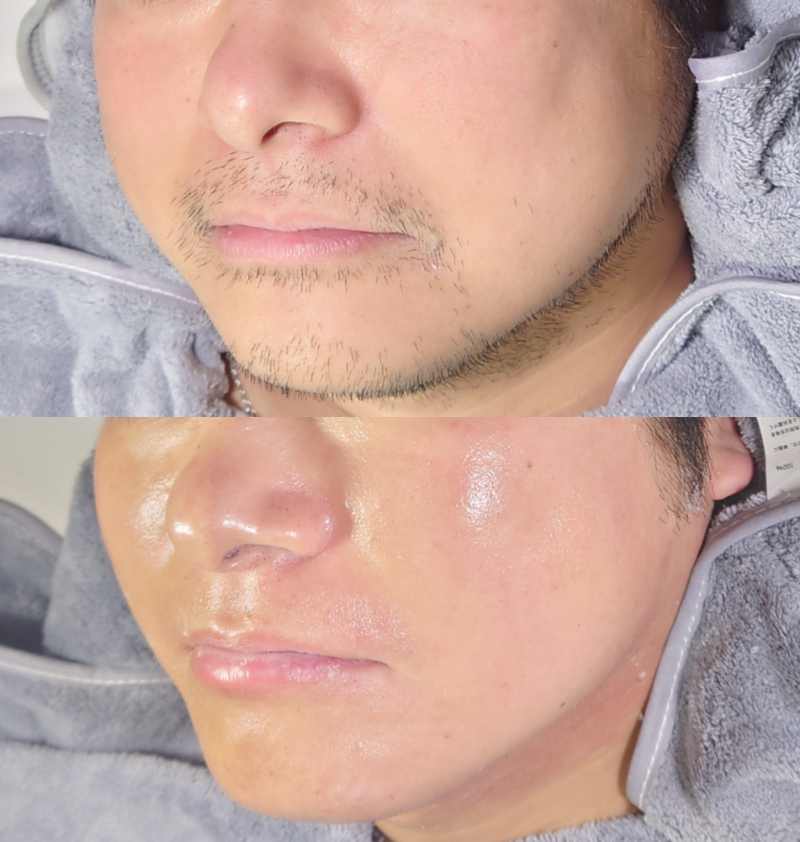 メンズ眉・肌特化サロン&Rheia(アンドレイア)｜Men'sBeauty掲載店舗