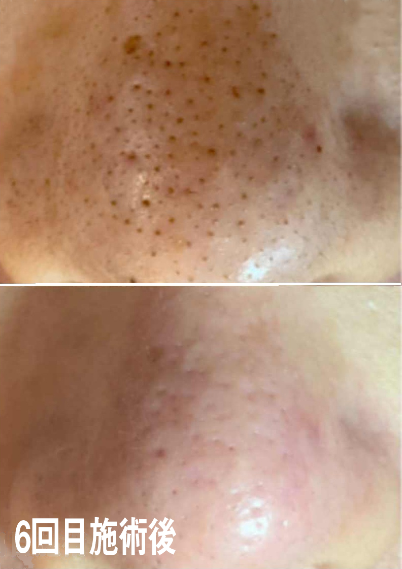 メンズ眉・肌特化サロン&Rheia(アンドレイア)｜Men'sBeauty掲載店舗