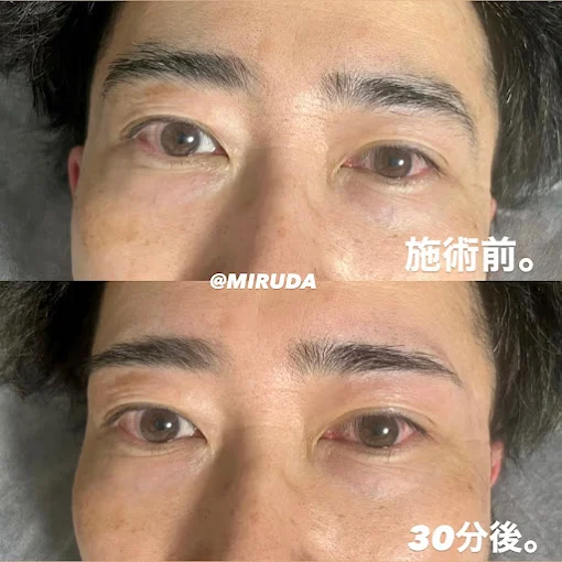 ブラジリアンワックス×光脱毛サロン　MIRUDA【ミルダ】｜Men'sBeauty掲載店舗